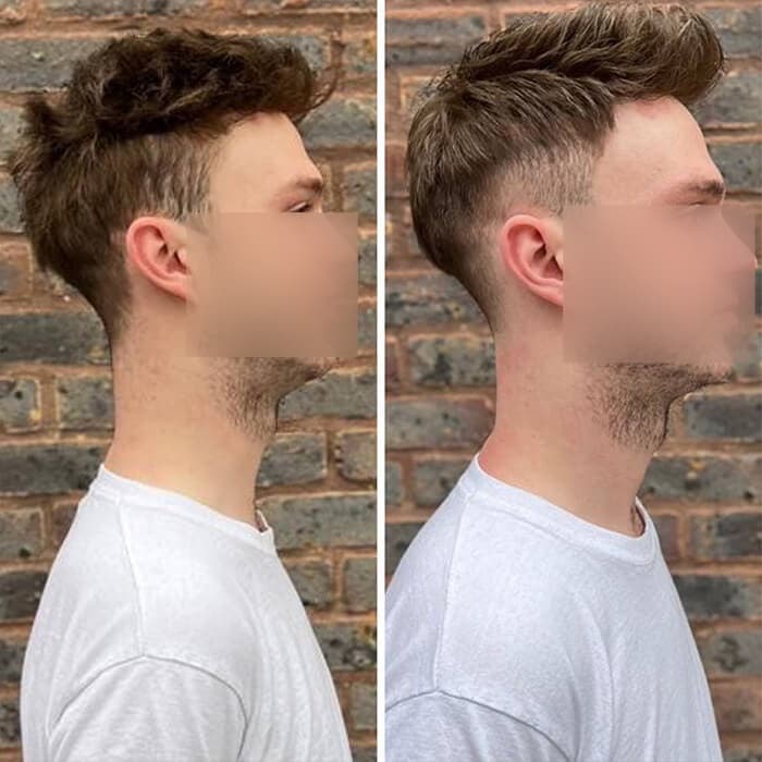 Client before and after: bald crown to textured fade