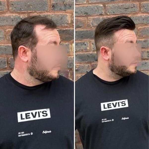 Client before and after: thinning to full styled hair