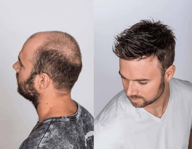 Man with a full, textured hair system styled away from his face