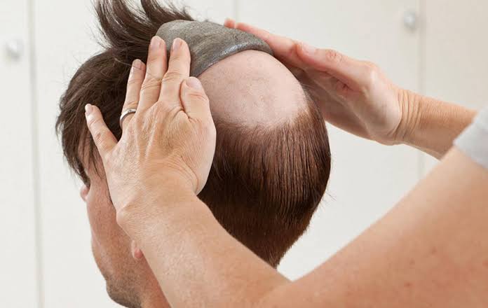 Hair System Maintenance & Reattachment