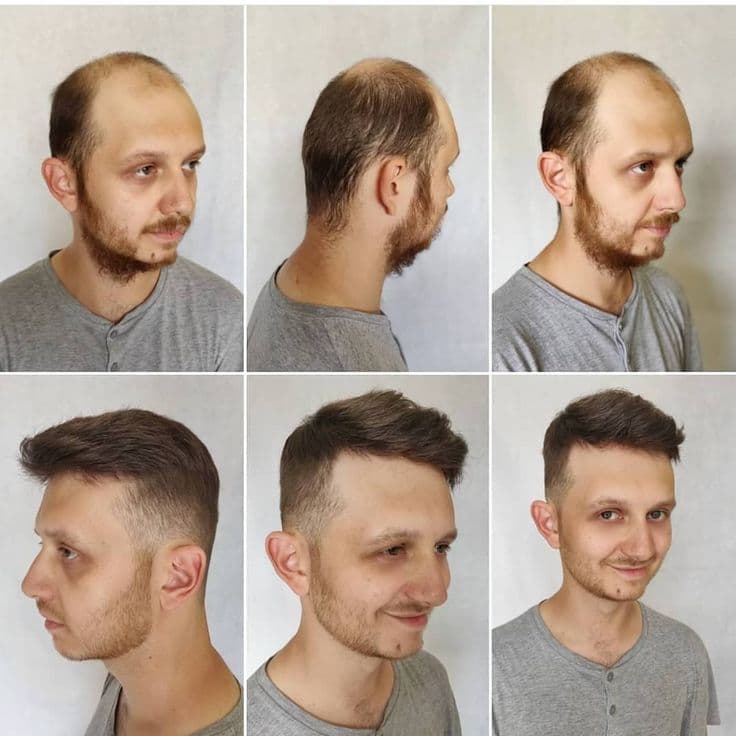 Men's hair transformation gallery: ManHair
