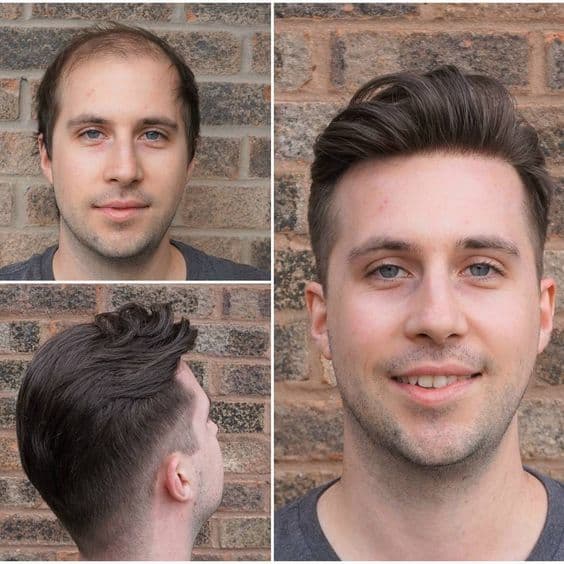 Men's Hairpieces