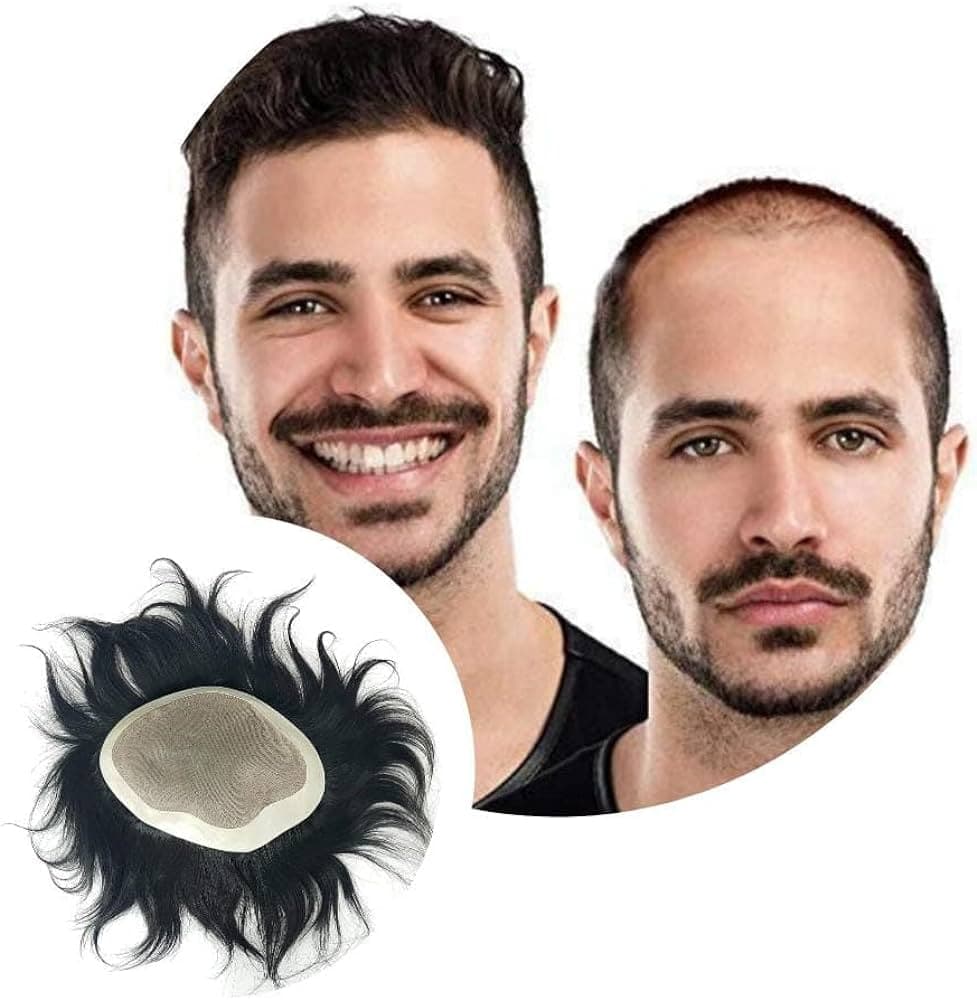 Before and after non-surgical hair replacement with hair system