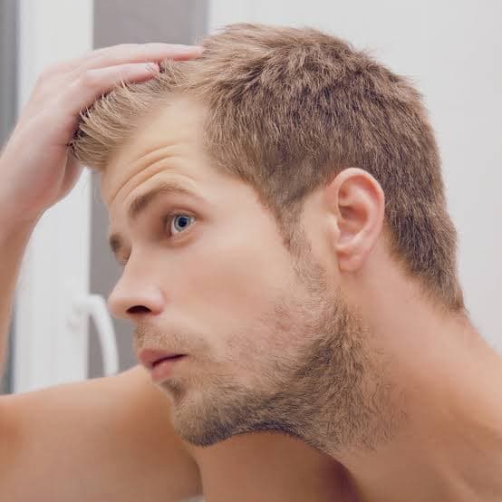 Checking a natural hairline after non-surgical replacement