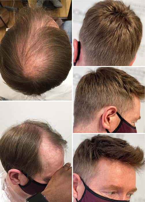 Collage of men in a hair studio during fittings, with salon chairs, close-up hairlines, and styled portraits