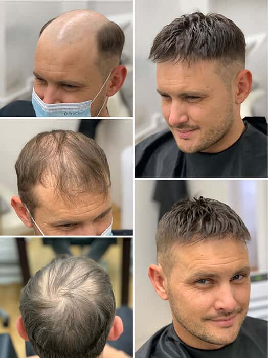Collage of a men's hair system studio, showing fitting chairs, hair color rings, and client portraits